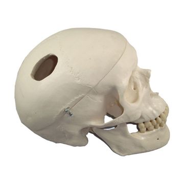 Picture of Classic Skull w/Drilled Holes Biomed Engineering