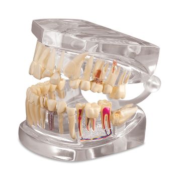 Picture of Dental Model Clear Human Jaw